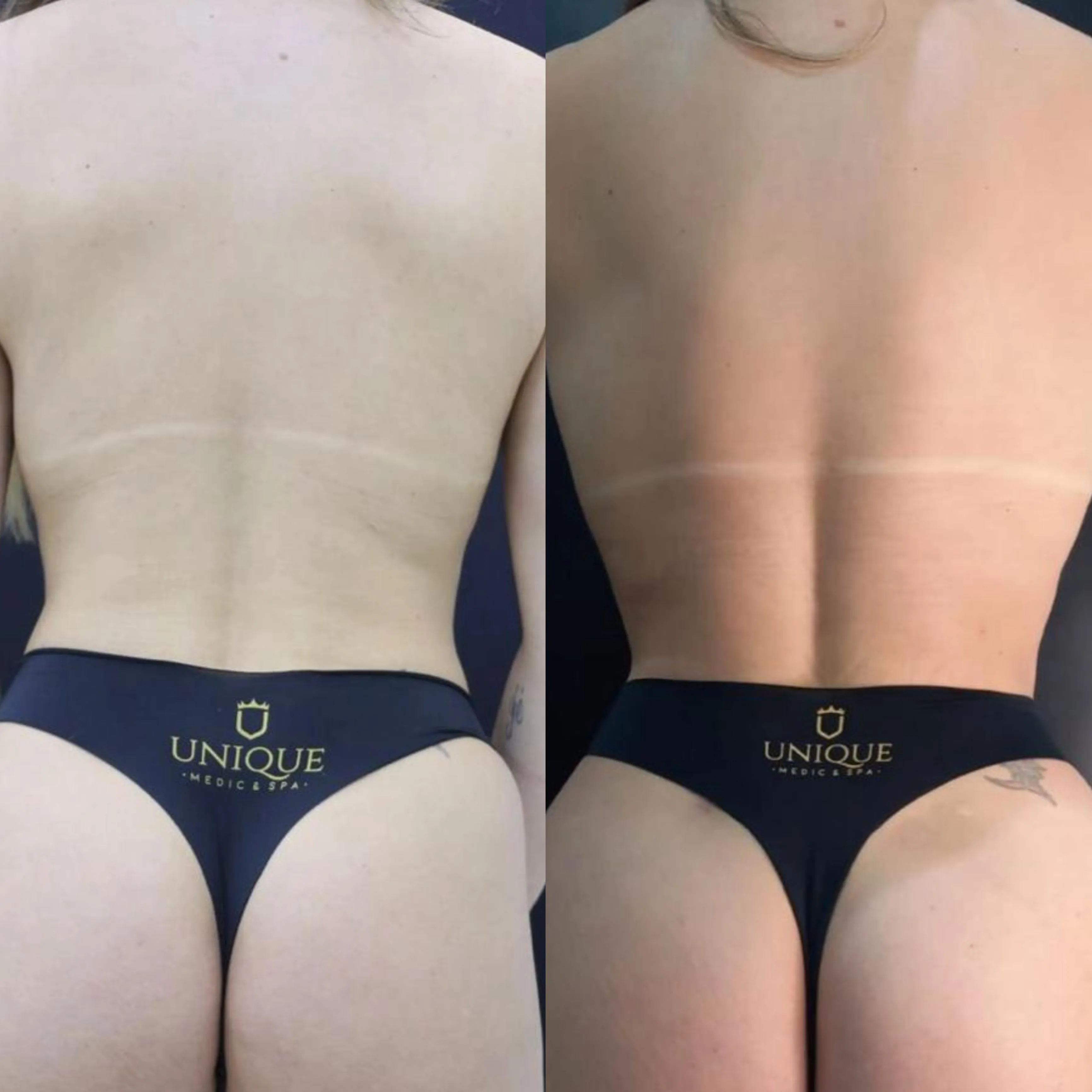 Antes e depois — resultado real