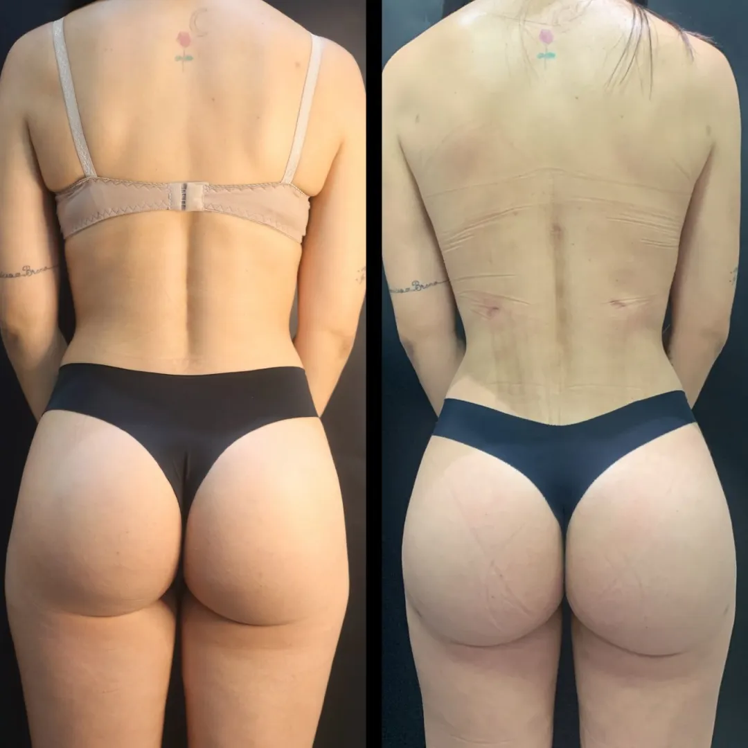 Antes e depois — resultado real