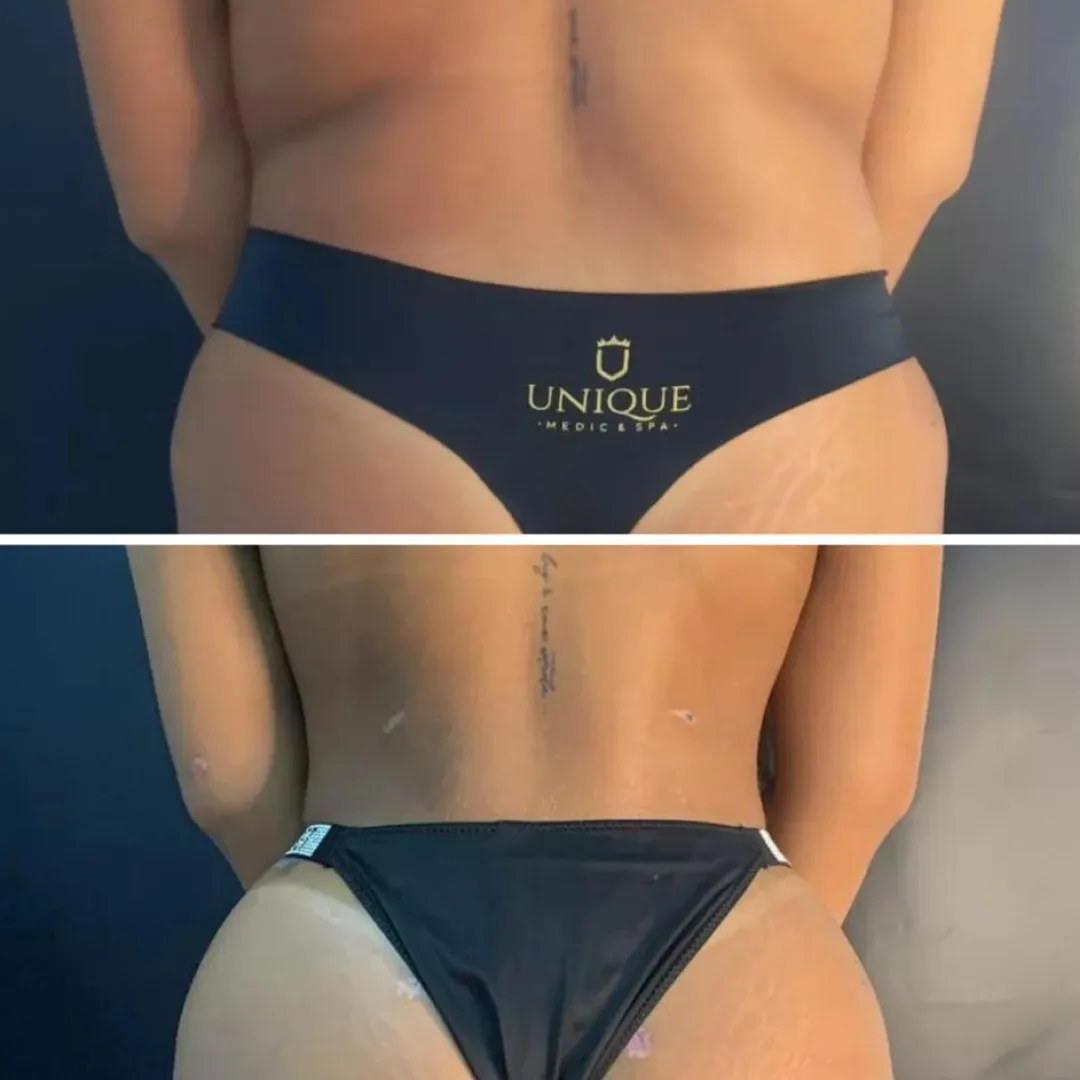 Antes e depois — resultado real